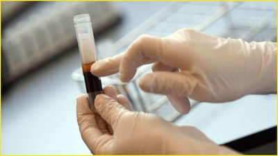 In a first, Indian doctors perform plasma therapy on COVID-19 patient at New Delhi's Max Hospital