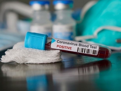 China's HIV drug experiment to treat novel coronavirus outbreak fails