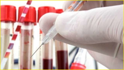 Clinical trials of Mycobacterium w vaccine as an adjunct to COVID-19 treatment will begin soon: PGMER Chandigarh
