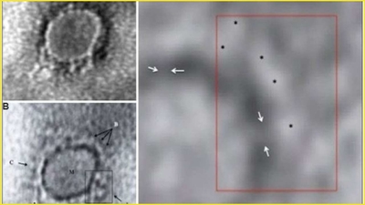 COVID-19: In a first, Indian scientists reveal first microscopic image of SARS-CoV-2 coronavirus strain