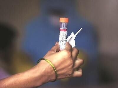 Johnson & Johnson's Covid-19 vaccine protected monkey in single shot